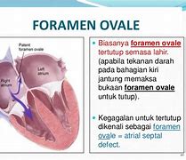 Oval Bahasa Indonesia